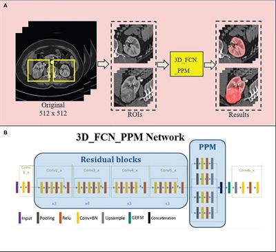 A novel 3D deep learning model to automatically demonstrate renal artery segmentation and its validation in nephron-sparing surgery